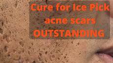 Acne Facial Treatment