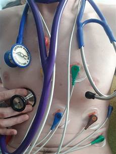 Adc Stethoscopes