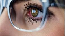Adult Sunglasses