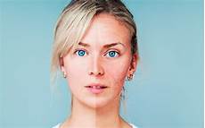 Ageless Skin Care