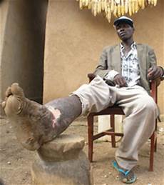 Aids Medicine