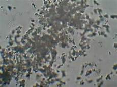 Alkaline Phosphate