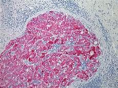 Alkaline Phosphate