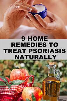Alternative Remedies Psoriasis