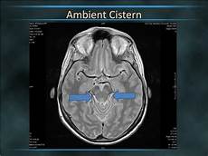 Ambient Cistern