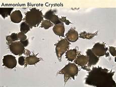 Ammonium Bicarbonate