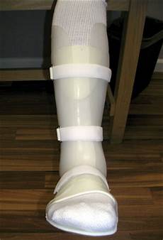 Ankle Socks