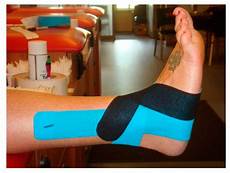 Ankle Support