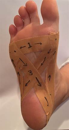 Ankle Support