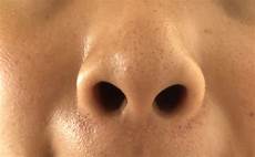 Anti Ageing