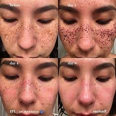 Anti Aging Skin