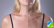 Anti Aging Skin