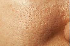 Anti Aging Skincare
