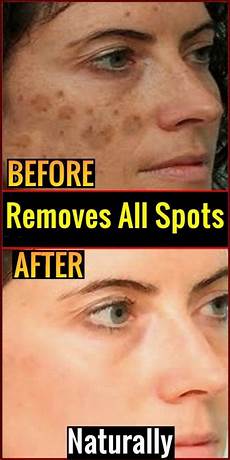 Anti Aging Skincare