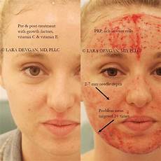 Anti Aging Treatments