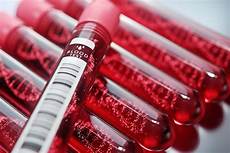 Anti Aging Vitamin