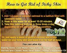 Anti Itching Soap