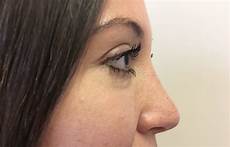 Anti Wrinkle