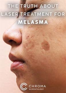 Antiaging Cosmetic
