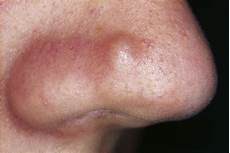Antibacterial Cleaners