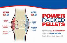 Arthritis Glucosamine Chondroitin Sulfate