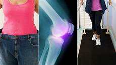 Arthritis Medication