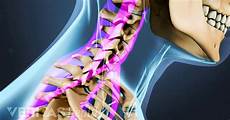 Arthritis Medication