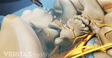 Arthritis Medication
