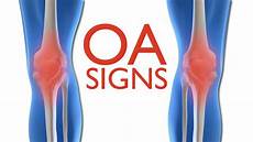 Arthritis Pain Spray