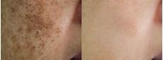 Ayurvedic Skin Products