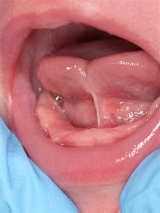 Baby Oral Hygiene