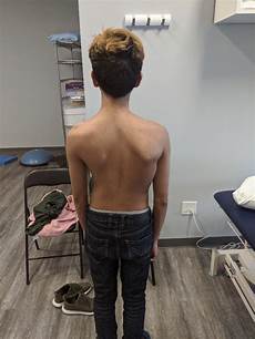 Back Pain