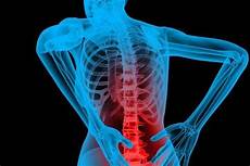 Back Pain