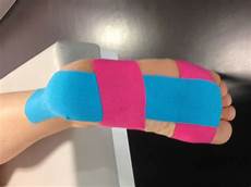 Bandage Tape