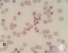 Blood Analyzers