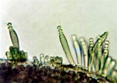 Blue Green Algae