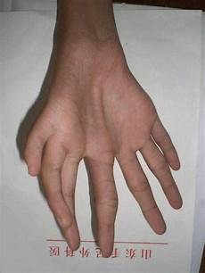 BodyParts