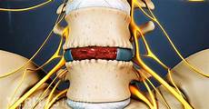 Bone Health