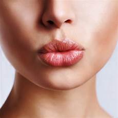 Chapped Lips