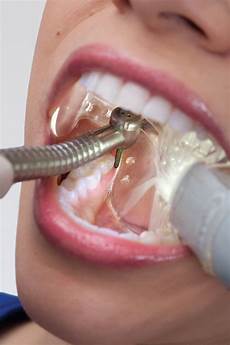 Dental Apparatus