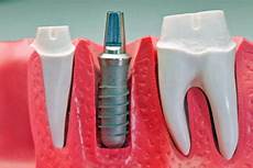 Dental Care