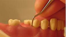 Dental Instruments
