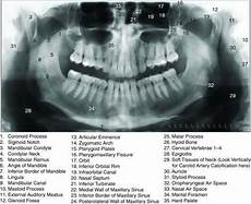 Dental Instruments
