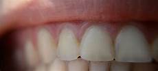 Dental Kit