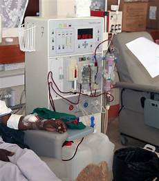 Dialysis machines