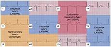 Ekg Leads