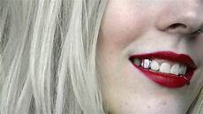 Fake Teeth