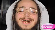 Fake Teeth