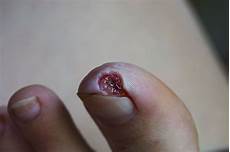 Flea Control