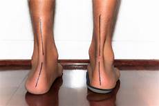Foot Orthotics
